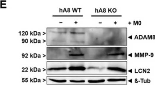 Co-culture of THP1-derived macrophages with Panc89 hA8 WT and KO cells. (A) The schematic model depicts the interactions of THP1-derived macrophages (green, M0) and Panc89 cells with or without ADAM8 (red). Created with BioRender.com. (B) ADAM8 mRNA expression in both Panc89 hA8 WT and KO is not affected by M0, whereas LCN2 mRNA expression. Data are presented as mean values ± S.D. *** p < 0.001. (C) is upregulated after co-culture in an ADAM8-dependent manner. Data are presented as mean values ± S.D. *** p < 0.001. (D) The graph illustrates the upregulation of MMP-9 mRNA expression in both Panc89 hA8 WT and KO after co-culture (n = 2). Data are presented as mean values ± S.D. *** p < 0.001. (E) Representative immunoblot shows the detection of ADAM8, MMP-9, and LCN2 with or without co-culture. In addition to the qPCR results, MMP-9 and LCN2 are upregulated after co-culture at the protein level (n = 2). (F) Representative zymography of Panc89 hA8 WT and KO cells with or without co-culture demonstrates less active MMP-9 in Panc89 hA8 KO cells than in Panc89 hA8 WT cells after co-culture. (G) Quantification of active MMP-9 refers to total MMP-9 in zymography of Panc89 hA8 WT and KO cells after co-culture (n = 2). Data are presented as mean values ± S.D. * p < 0.05. Representative images of Panc89 cells before and after co-culture are shown in (H); scale bar, 100 μm. After co-culture, morphological changes are visible in both Panc89 hA8 WT and KO cells. Image collected and cropped by CiteAb from the following open publication (//pubmed.ncbi.nlm.nih.gov/35216088), licensed under a CC-BY license. Not internally tested by R&D Systems.
