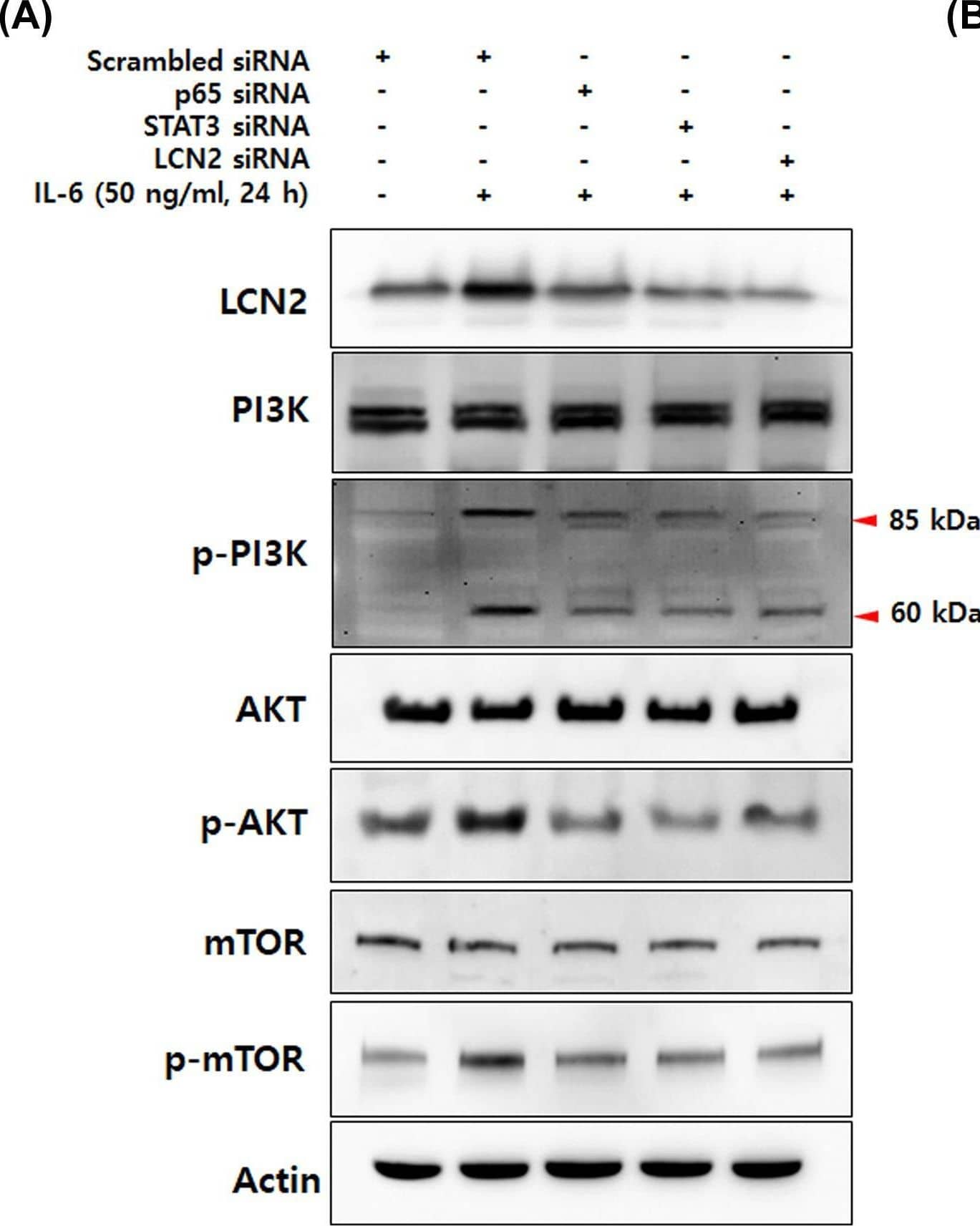 IL-6-induced LCN2 regulates cell survival and anti-apoptotic molecules mediated by the NF-kB/STAT3 pathway(A) After transfection with p65, STAT3 and LCN2 siRNA, DLD-1 cells were stimulated with 50 ng/ml IL-6 for 24 h, total extracts of DLD-1 cells were prepared and used to determine the phosphorylation of PI3k/AKT/mTOR. Actin was used as a loading control. (B) Total extracts prepared by the same methods were analyzed to determine the protein levels that are target gene products of STAT3 and NF-kB. Actin was used as a loading control. All images are representatives from at least three independent experiments. Image collected and cropped by CiteAb from the following open publication (//pubmed.ncbi.nlm.nih.gov/35470375), licensed under a CC-BY license. Not internally tested by R&D Systems.