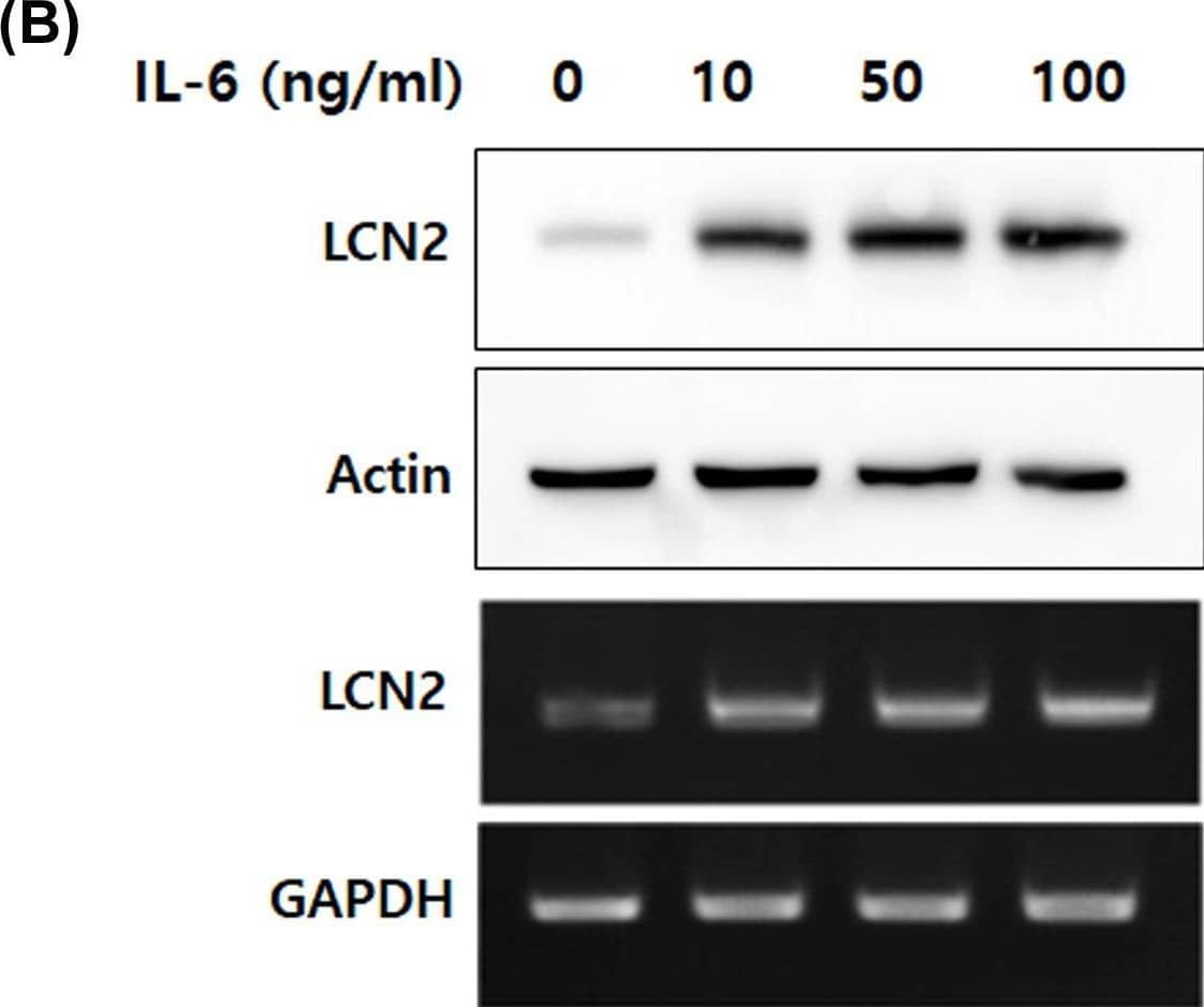 IL-6 specifically up-regulated LCN2 protein and mRNA levels in human CRC cells(A,B) After stimulation with IL-6, protein and mRNA of DLD-1 cells were isolated. Then, Western blotting and reverse-transcriptase PCR were performed. The top images are Western blots and lower images are reverse-transcriptase PCR. (C) Human CRC cell lines, SW480 and HT-29, were stimulated with 50 ng/ml IL-6 for 24 h, then the levels of LCN2 protein and mRNA were detected. All images are representatives from at least three independent experiments. Image collected and cropped by CiteAb from the following open publication (//pubmed.ncbi.nlm.nih.gov/35470375), licensed under a CC-BY license. Not internally tested by R&D Systems.