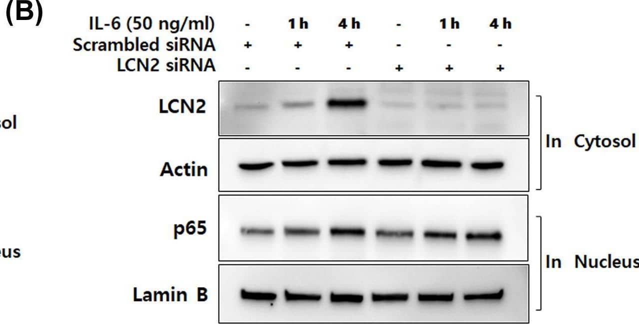 IL-6-specific up-regulation of LCN2 is dependent on NF-kappa B activation in human CRC cells(A) After stimulation with 50 ng/ml IL-6 for the indicated time, cytosolic and nuclear extracts of DLD-1 cells were prepared and used to determine the translocation of p65 from the cytosol to the nucleus. Actin and lamin B were used as loading controls. (B) After transfection with LCN2 siRNA, DLD-1 cells were stimulated with 50 ng/ml IL-6. Then the level of LCN2 in the cytosol and p65 in the nucleus were analyzed by Western blotting. Actin and lamin B were used as loading controls. (C) The cells were stimulated after transfection with p65 siRNA, then the levels of LCN2 and p65 were analyzed by Western blotting (upper panel). Cells were stimulated with IL-6 after pretreatment with PT and BAY11-7082 (NF-kappa B-specific inhibitor). Then, the levels of LCN2 and p65 were detected using Western blot analysis (lower panel). Actin was used as a loading control. All images are representatives from at least three independent experiments. Image collected and cropped by CiteAb from the following open publication (//pubmed.ncbi.nlm.nih.gov/35470375), licensed under a CC-BY license. Not internally tested by R&D Systems.