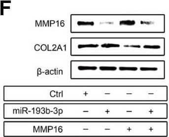Western Blot MMP-16/MT3-MMP Antibody [Unconjugated]