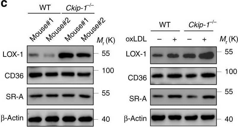 Western Blot SR-AI/MSR Antibody [Unconjugated]