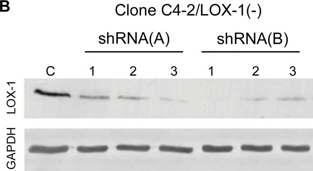 <b>Genetic Strategies Validation. </b>Generation of stable prostate cancer cell lines with LOX-1 over-expression and shRNA against olr1.A) Western blot for LOX-1 (40 kDa) expression in human CaP clones with overexpression of LOX-1. B) Western blot for LOX-1 (40 kDa) expression in human prostate cancer cell clones with LOX-1 knockdown C) Real-time PCR for LOX-1 expression in three clones with overexpression of LOX-1. D) Real-time PCR for LOX-1 expression was determined in three clones that express shRNA/LOX-1(A), and three clones that express shRNA/LOX-1(B). The data represent the means ± S.D. of three independent experiments performed in triplicate, and statistically analyzed using one-way analysis of variance and Dunnett’s post-test; (***p≤0.001, **p≤0.01, *p≤0.05). Image collected and cropped by CiteAb from the following publication (//pubmed.ncbi.nlm.nih.gov/25170920), licensed under a CC-BY license. Not internally tested by R&D Systems.
