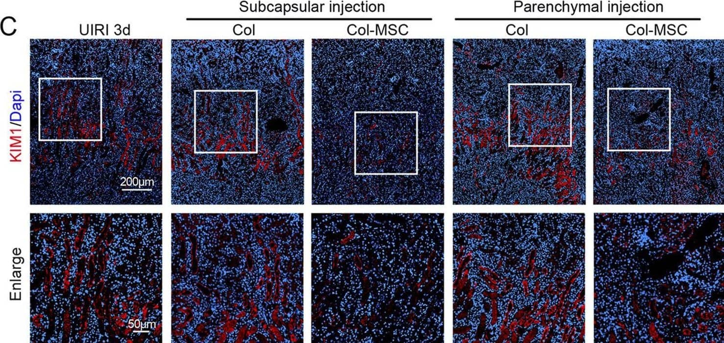 Immunohistochemistry TIM-1/KIM-1/HAVCR Antibody [Unconjugated]