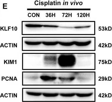 Downregulation of KLF10 was correlated with cell proliferation and the outcome of cisplatin-induced AKI in vivo. A Flowchart detailing cisplatin treatment regime in C57BL/6 J mice. n = 6 per group. B Representative H&E staining image of kidney sections from the model. C Representative immunofluorescence staining image of Ki67 in the model and counts of positive cells per 40x field (objective lens). D Renal dysfunction was determined in cisplatin (20 mg/kg, ip) treated mouse model. Serum creatinine (SCr) was measured in sera. Degree of renal injury was determined in the model through relative mRNA levels of KIM1, NGAL and IGFBP7 in mouse kidney tissues. Degree of renal cellular proliferation was determined in the model through relative mRNA levels of PCNA, FOXM1 and Ki67 in mice kidney tissues. E Representative immunoblot analysis of KLF10, KIM1 and PCNA in the model. ACTIN served as the standard. F Regression analysis was undertaken to determine correlation between relative protein level of KLF10 in mice kidney tissues and SCr. Relative protein level of KLF10 was examined and normalized by Fiji. G–I Representative immunofluorescence staining image and rate of positive nuclear of KLF10 in the model. *p < 0.05, **p < 0.01, ***p < 0.001, ns no significantly difference vs control group at the same experimental conditions. Image collected and cropped by CiteAb from the following open publication (//pubmed.ncbi.nlm.nih.gov/36878898), licensed under a CC-BY license. Not internally tested by R&D Systems.