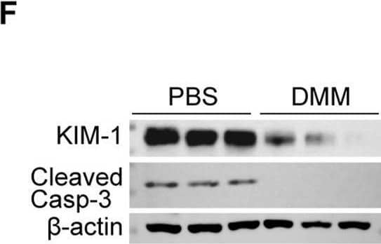 DMM inhibited UUO-induced renal fibrosis and injury. (A) The schematic of the experimental design. (B) The succinate content in PBS- and DMM-treated UUO kidneys (n = 5). (C) Immunoblots and (D) quantification of Col I and  alpha SMA in UUO kidneys from mice treated with or without DMM (n = 3). (E) Representative Masson staining and quantification of UUO kidneys from mice treated with or without DMM (n = 5). (F) Immunoblots and (G) quantification of KIM1 and cleaved caspase-3 in UUO kidneys from mice treated with or without DMM (n = 3). The results represent mean ± SEM. *P < 0.05, **P < 0.01, ***P < 0.001. Image collected and cropped by CiteAb from the following open publication (//pubmed.ncbi.nlm.nih.gov/40556756), licensed under a CC-BY license. Not internally tested by R&D Systems.