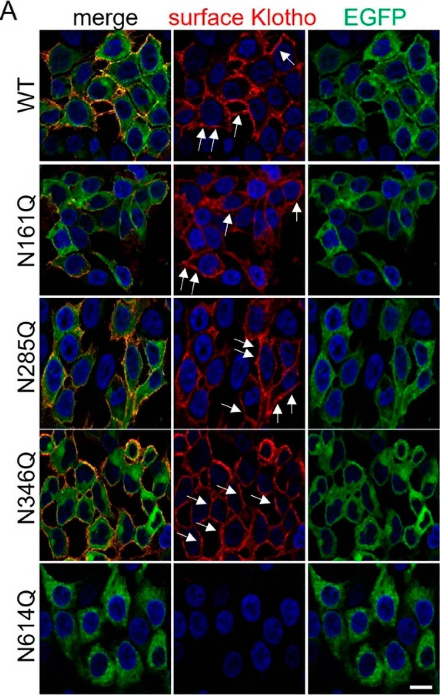 Klotho-EGFP N614Q is not transported to the cell surface. (A,B) HEK293 cells stably expressing Klotho-EGFP variants were subjected to surface immunofluorescence using an anti-Klotho antibody (red) and imaged via immunofluorescence. (B) Cells processed as in (A) were imaged using higher exposure times to visualize the small amounts of Klotho-EGFP N614Q at the PM. Nuclei were stained with Hoechst 33342 in blue. Single Apotome sections are shown. Arrows indicated PM localization. Scale bar 10 μm. (C,D) Lysates and supernatants of HEK293T cells stably expressing Klotho-EGFP variants were separated by SDS-PAGE followed by Western blotting using Klotho antibody. (D) Quantification of the ratio of mature/total Klotho-EGFP. sKl indicates shed Klotho. n = 4 independent experiments. (E,F) HEK293 cells stably expressing Klotho-EGFP variants were subjected to surface biotinylation, lysed, precipitated with streptavidin beads, separated on SDS-PAGE, and blotted for Klotho and EEA1 as a cytosolic control protein. * indicates Klotho remnant staining from incomplete stripping. (F) Quantification of n = 4 independent experiments from (E). The ratio of surface/total of Klotho-EGFP WT was set to 100, and the ratio of surface/total of Klotho-EGFP N614Q related to that. A Student’s t-test was used. Data are shown as mean ± standard deviation (SD). * denote levels of significance, **** indicating p < 0.0001, ns: non-significant. For full-size blots, see Supplementary Figure S1. Image collected and cropped by CiteAb from the following open publication (//pubmed.ncbi.nlm.nih.gov/39451260), licensed under a CC-BY license. Not internally tested by R&D Systems.
