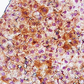Immunohistochemistry C-Reactive Protein/CRP Antibody [Unconjugated]