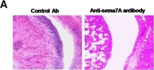 Blocking of semaphorin 7A (Sema7A) attenuates severity of collagen-induced arthritis (CIA) in mice. a Histological examination of a mouse ankle joint on day 50 after treatment with anti-Sema7A antibody. Sections were stained with hematoxylin and eosin. Original magnification × 400. b and c Average arthritis scores and paw swelling of mice with CIA. Mice (n = 8 per group) were immunized with collagen type II, randomized, and, at onset of disease (clinical score of 4), anti-Sema7A or control antibody (Ab) (12 μg/mouse) was administered intraperitoneally on days 1, 10, 20, 30, and 40 (n = 8 mice per group). Data are representative of three independent experiments. d Average histologic scores of paw sections on day 50 (n = 8 mice per group). e Serum samples were collected for expression of tumor necrosis factor-alpha  (TNF-alpha ), interleukin-17 (IL-17), and IL-6 by enzyme-linked immunosorbent assay on day 50 (n = 8 mice per group). Data were compiled from three independent experiments. Values are mean ± SEM. **P < 0.01 Image collected and cropped by CiteAb from the following open publication (//pubmed.ncbi.nlm.nih.gov/28109308), licensed under a CC-BY license. Not internally tested by R&D Systems.