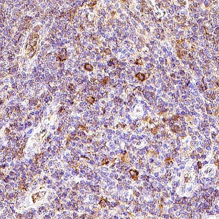 NKp46/NCR1 was detected in immersion fixed paraffin-embedded sections of human lymph node using Goat Anti-Human NKp46/NCR1 Antigen Affinity-purified Polyclonal Antibody (Catalog # AF1850) at 8 &micro;g/mL for 1 hour at room temperature followed by incubation with the Anti-Goat IgG VisUCyte&trade; HRP Polymer Antibody (VC004). Before incubation with the primary antibody, tissue was subjected to heat-induced epitope retrieval using Antigen Retrieval Reagent-Basic (CTS013). Tissue was stained using DAB (brown) and counterstained with hematoxylin (blue). Specific staining was localized to cytoplasm in lymphocytes.