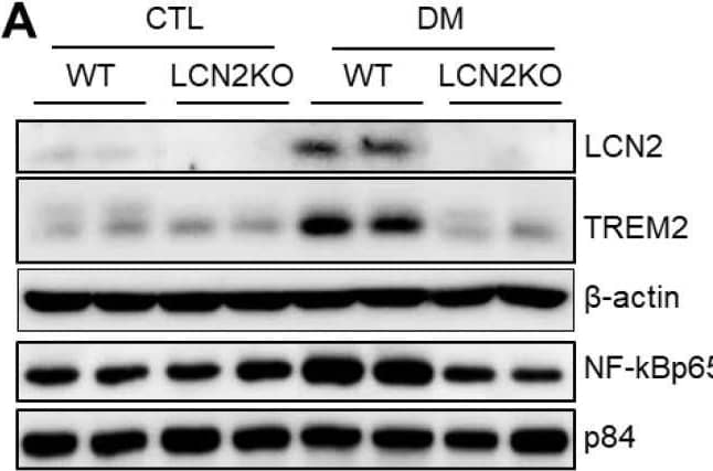 Effects of LCN2 deletion on microglial activation and hippocampal TREM2 expression in HFD/STZ-induced diabetic mice: (A,B) Western blot analysis and quantification of LCN2, TREM2, and NF-kappa Bp65 in the hippocampus;  beta -actin and p84 were used as loading controls for total protein and nuclear protein, respectively; (C) representative immunofluorescence images of TREM2 (red) and Iba-1 (green) in hippocampal sections; DAPI (blue) was used to stain nuclei; scale bar = 10 µm; (D) quantification of co-localized TREM2 and Iba-1-immunostained cells in the images. CTL: control; DM: diabetic mice. Data are presented as the mean ± SEM. The indicated p-values represent a two-way ANOVA, followed by Tukey’s post hoc test. * p  <  0.05 vs. WT CTL. † p < 0.05 vs. WT DM. Image collected and cropped by CiteAb from the following open publication (//pubmed.ncbi.nlm.nih.gov/35884685), licensed under a CC-BY license. Not internally tested by R&D Systems.