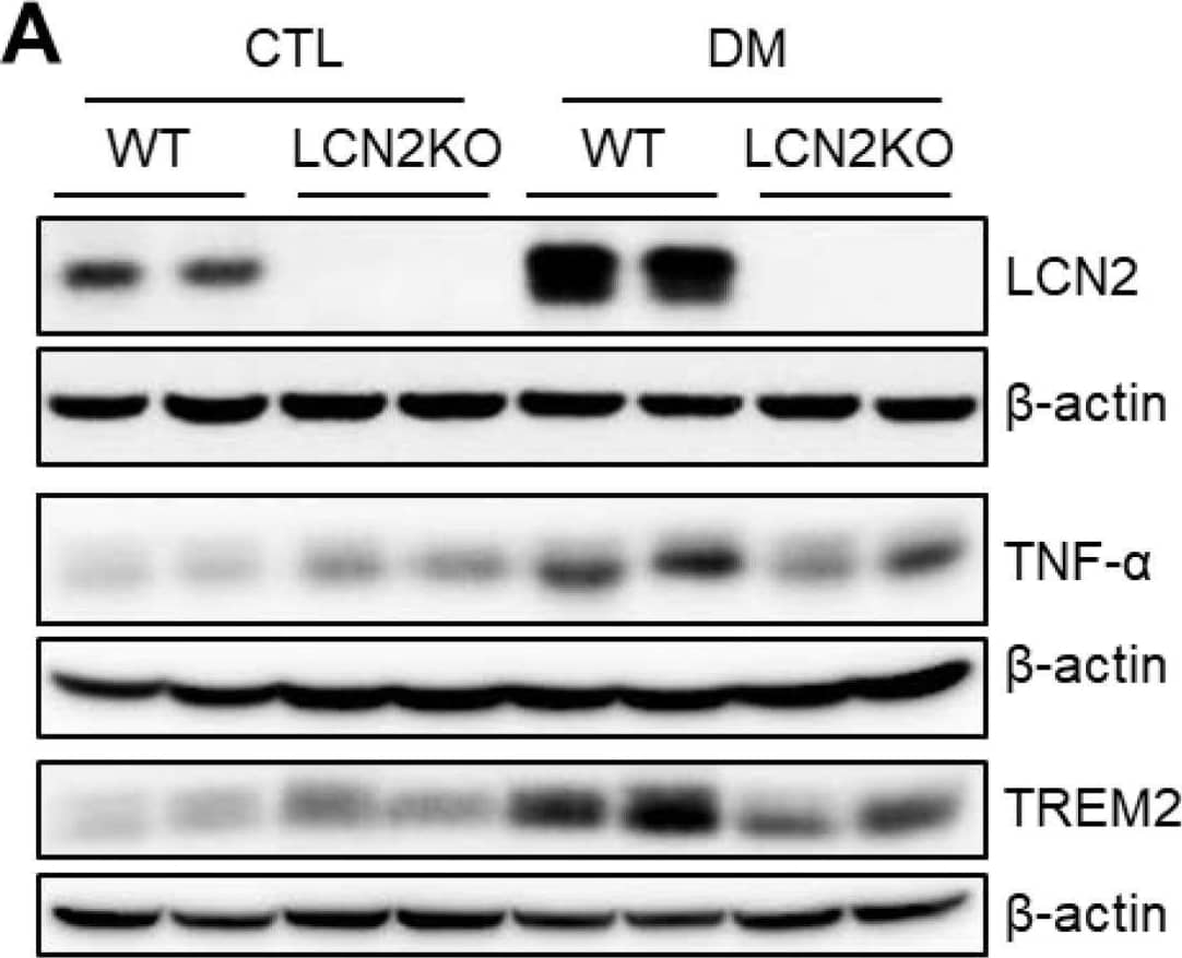 Effects of LCN2 deletion on hepatic TREM2 expression in HFD/STZ-induced diabetic mice: (A,B) Western blot analysis and quantitation of LCN2, TNF-  alpha , and TREM2 proteins in liver lysates.  beta -actin was used as loading control; (C) representative immunofluorescence images of TREM2 (red) and F4/80 (green) in liver sections; CV: central vein; (D) quantification of co-localized TREM2 and F4/80-immunostained cells in the images; (E) representative immunofluorescence images of TREM2 (red) and Ly6G (green) in liver section; quantification of co-localized TREM2 and Ly6G-immunostained cells in the images; scale bar = 10 µm. DAPI (blue) was used to stain nuclei. CTL: control; DM: diabetic mice. Data are presented as the mean ± SEM. The indicated p-values represent a two-way ANOVA, followed by Tukey’s post hoc test. * p  <  0.05 vs. WT CTL. † p < 0.05 vs. WT DM. Image collected and cropped by CiteAb from the following open publication (//pubmed.ncbi.nlm.nih.gov/35884685), licensed under a CC-BY license. Not internally tested by R&D Systems.