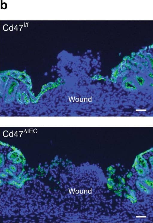 IEC-specific deletion of CD47 results in impaired mucosal healing. Utilizing a miniature video endoscope and biopsy scissors, 5–7 wounds were created in the dorsal aspect of the descending colon mucosa of anesthetized mice. Cd47ER delta IEC mice were wounded 2 weeks after tamoxifen treatment. a Digital measurement of wound surface area at 24 and 72 h post wounding revealed a striking impairment in wound closure in Cd47 delta IEC and tamoxifen-treated Cd47ER delta IEC mice. Points represent mean value within all wounds from an individual mouse. Data are representative of two independent experiments with 5–6 mice per group. Data are means ± SEM. ***p < 0.001; one-way ANOVA. b Tissue sections taken from day 3 wounds were stained with the epithelial-specific marker E-Cadherin (green), plus DAPI counterstain (blue). Re-epithelialization of the wound is disorganized in the absence of CD47 (Cd47 delta IEC) compared with control Cd47f/f. c Tissue sections taken from day 3 wounds were stained with the epithelial-specific marker E-Cadherin (green), brush border protein Villin (magenta), and DAPI (blue). Insets of epithelial cells on top of the wound bed show polarized wound-associated epithelial cells (WAE) expressing Villin (arrows) in Cd47f/f wounds while cells are not polarized in Cd47 delta IEC wounds. Scale bars = 100 μm. d Ki67 staining of frozen sections of wounded colon mucosa 3 days post-wounding (red) revealed similar proliferation rates in crypt epithelial cells immediately adjacent to wounds in the absence of epithelial CD47. Sections were counterstained with E-Cadherin (green) and DAPI (blue). Scale bars = 50 μm. Points represent the average number of Ki67-positive cells for four crypts adjacent to wounds for each individual mouse. Data are means ± SEM and are representative of two independent experiments with 4–6 mice per group. Source data are provided as a Source Data file Image collected and cropped by CiteAb from the following publication (//pubmed.ncbi.nlm.nih.gov/31676794), licensed under a CC-BY license. Not internally tested by R&D Systems.