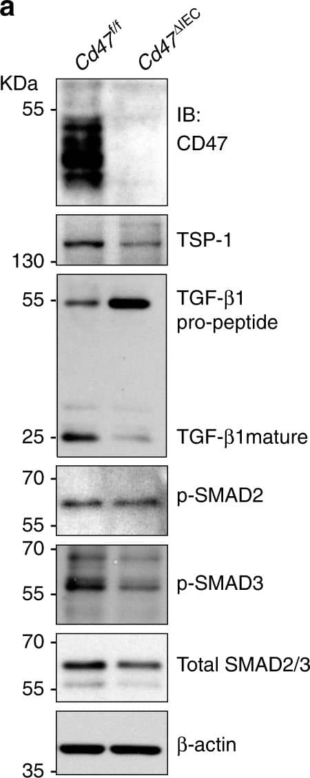 CD47 regulates thrombospondin-1, TGF-beta 1, and collagen deposition after injury. a Whole cell lysates from freshly isolated intestinal epithelial cells from Cd47f/f and Cd47 delta IEC mice were subjected to SDS–PAGE and immunoblot for thrombospondin-1/TSP-1, TGF-beta 1, and phosphorylated SMAD2 and SMAD3. Results are representative of three independent experiments. b Representative Masson’s trichrome staining of wounds beds and chronic DSS-colitis colons from Cd47f/f and Cd47 delta IEC mice. Scale bars = 50 μm. Results representative of three independent experiments with 5–7 mice per group. Source data are provided as a Source Data file Image collected and cropped by CiteAb from the following publication (//pubmed.ncbi.nlm.nih.gov/31676794), licensed under a CC-BY license. Not internally tested by R&D Systems.