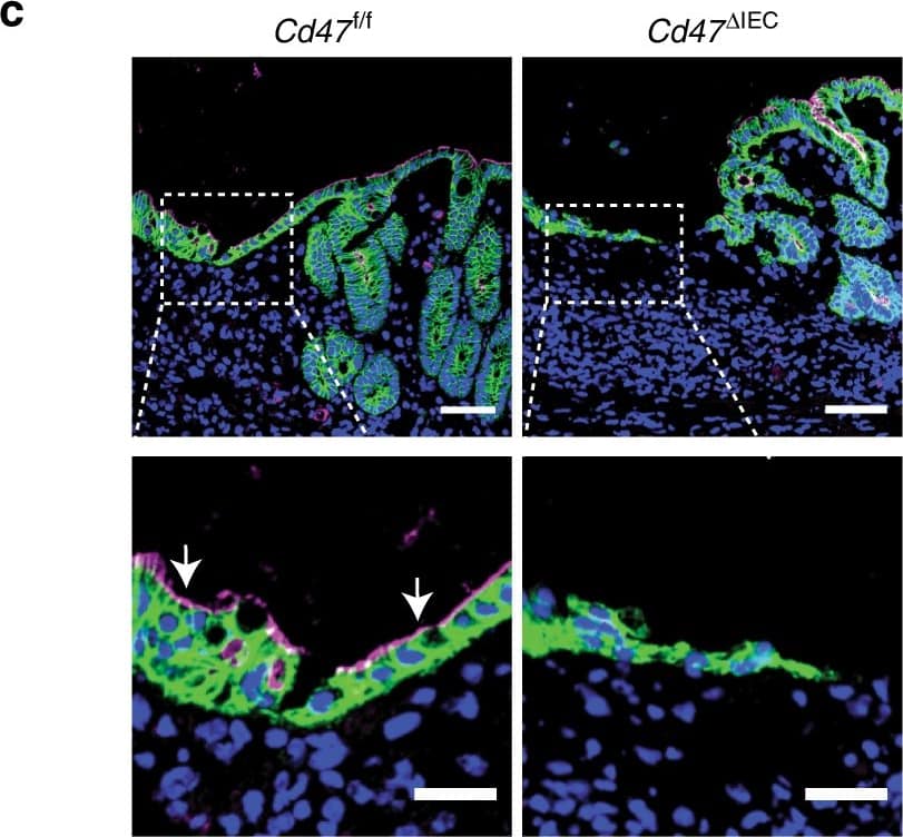 IEC-specific deletion of CD47 results in impaired mucosal healing. Utilizing a miniature video endoscope and biopsy scissors, 5–7 wounds were created in the dorsal aspect of the descending colon mucosa of anesthetized mice. Cd47ER delta IEC mice were wounded 2 weeks after tamoxifen treatment. a Digital measurement of wound surface area at 24 and 72 h post wounding revealed a striking impairment in wound closure in Cd47 delta IEC and tamoxifen-treated Cd47ER delta IEC mice. Points represent mean value within all wounds from an individual mouse. Data are representative of two independent experiments with 5–6 mice per group. Data are means ± SEM. ***p < 0.001; one-way ANOVA. b Tissue sections taken from day 3 wounds were stained with the epithelial-specific marker E-Cadherin (green), plus DAPI counterstain (blue). Re-epithelialization of the wound is disorganized in the absence of CD47 (Cd47 delta IEC) compared with control Cd47f/f. c Tissue sections taken from day 3 wounds were stained with the epithelial-specific marker E-Cadherin (green), brush border protein Villin (magenta), and DAPI (blue). Insets of epithelial cells on top of the wound bed show polarized wound-associated epithelial cells (WAE) expressing Villin (arrows) in Cd47f/f wounds while cells are not polarized in Cd47 delta IEC wounds. Scale bars = 100 μm. d Ki67 staining of frozen sections of wounded colon mucosa 3 days post-wounding (red) revealed similar proliferation rates in crypt epithelial cells immediately adjacent to wounds in the absence of epithelial CD47. Sections were counterstained with E-Cadherin (green) and DAPI (blue). Scale bars = 50 μm. Points represent the average number of Ki67-positive cells for four crypts adjacent to wounds for each individual mouse. Data are means ± SEM and are representative of two independent experiments with 4–6 mice per group. Source data are provided as a Source Data file Image collected and cropped by CiteAb from the following publication (//pubmed.ncbi.nlm.nih.gov/31676794), licensed under a CC-BY license. Not internally tested by R&D Systems.