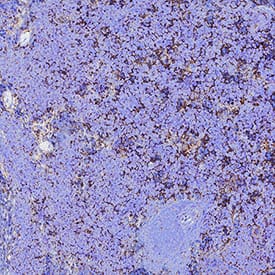 CD47 was detected in immersion fixed paraffin-embedded sections of Mouse Spleen using Goat Anti-Mouse/Rat CD47 N-terminal IgV-like Extracellular Domain Antigen Affinity-purified Polyclonal Antibody (Catalog # AF1866) at 1 &micro;g/mL for 1 hour at room temperature followed by incubation with the HRP-conjugated Anti-Goat IgG Secondary Antibody (Catalog # HAF017). Before incubation with the primary antibody, tissue was subjected to heat-induced epitope retrieval using VisUCyte Antigen Retrieval Reagent-Basic (Catalog # VCTS021). Tissue was stained using DAB (brown) and counterstained with hematoxylin (blue). Specific staining was localized to Cell surface and cytoplasm.  View our protocol for Chromogenic IHC Staining of Paraffin-embedded Tissue Sections.