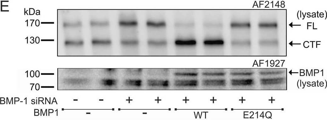 Western Blot BMP-1/PCP Antibody [Unconjugated]