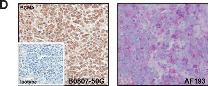 Immunohistochemistry BCMA/TNFRSF17 Antibody [Unconjugated]