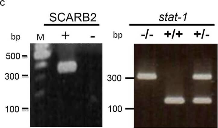 Generation of a hybrid mouse model SCARB2/stat-1 KO by crossbreeding hSCARB2 transgenic mice and stat-1 KO mice.(a) Human SCARB2 (hSCARB2) cDNA was cloned under its own native promoter in an SV40 expression vector. (b) The generation of homozygous hSCARB2+/+ transgenic mice was as detailed in M&M. The heterozygote strain of hSCARB2+/−/stat-1+/− mice were generated by crossing the stat-1−/− and the hSCARB2+/+ parental mice. The hybrid strain hSCARB2+/+/stat-1−/− was generated by crossing the heterozygote mice hSCARB2+/−/stat-1+/− to each other. (c) Genotyping of parental and hybrid mouse strains was performed by PCR assay using genomic DNAs extracted from mouse tail. The transgene of hSCARB2 was screened by detection of a 369 bp PCR product using primers specific for hSCARB2. For the stat-1+/− heterozygote mice, 320 bp and 150 bp PCR products were used as markers for screening. The former indicates a mutant stat-1 allele, while the latter indicates a wild type stat-1 allele. (d) The expressions of hSCARB2 protein were compared among parental and hybrid mouse strains in brain, spinal cord, spleen and muscle by immunoblot via an anti-SCARB2 antibody. The weaker signals of the SCARB2 protein detected in stat-1 KO mice reflect cross reactivity between human and mouse SCARB2 proteins to the anti-SCARB2 antibody. Image collected and cropped by CiteAb from the following open publication (//pubmed.ncbi.nlm.nih.gov/27499235), licensed under a CC-BY license. Not internally tested by R&D Systems.