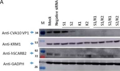 The reduction of endogenous hSCARB2 and KRM1 expression impacted CVA10 infection. RD Cells were transfected individually with 50 pmoles of siRNA specific to hSCARB2 (s2651(S1) and s2652(S2)), KRM1 (s38393(K1) and s38394(K2)), or mixed specific siRNA with equal amounts (50 + 50 pmoles) of S1 + K1, S1 + K2, S2 + K1, S2 + K2, or negative siRNA, followed by 48 h of incubation. Infection of siRNA-treated cells with CVA10 (MOI = 0.05) and then cultured for another 24 h then proceeded. (a) Western blotting with the respective antibody examined the expression level of hSCARB2 or KRN1 in the cells. (b) The supernatant and (c) lysate were collected and subjected to a plaque-forming assay to detect the amounts of produced CVA10, and the results were shown. (d) Total amounts of CVA10 production using the sum of the viral amounts from (b,c) are shown. The symbols **, *** and **** were used to indicate p  <  0.01, p  < 0.001, and p  < 0.0001, respectively. Image collected and cropped by CiteAb from the following open publication (//pubmed.ncbi.nlm.nih.gov/37112912), licensed under a CC-BY license. Not internally tested by R&D Systems.