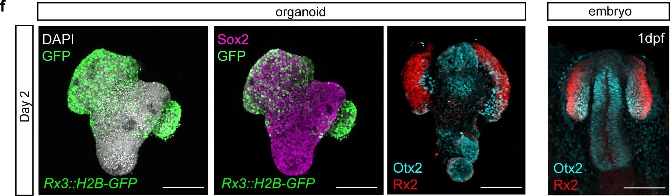 Medaka primary embryonic pluripotent cells form optic vesicle-like structures. (f) Maximal projection of day 2 organoids&1 dpf embryo generated from Rx3::H2B-GFP transgenic or wild-type blastulae&stained with neural tissue-specific anti-Sox2 (n = 12/12)&anti-Otx2 (n = 10/10) antibodies, co-stained with anti-Rx2&DAPI nuclear stain. hpa, hours post-aggregation; dpf, days post-fertilization. Scale bars: 100 μm.Overview of complexity&variability of organoid morphology generated within one experiment.Overlay of fluorescence&bright-field images of retinal organoids on day 2 generated from the Rx3::H2B-GFP reporter line formed by aggregation of <1000 primary embryonic pluripotent cells stained with anti-GFP antibody. Scale bar: 100 μm.Examples of organoids generated by aggregation of <1000 cells forming one, two,&three optic vesicle-like structures.Fluorescence images, bright-field images,&their overlay of retinal organoids on day 2 generated from the Rx3::H2B-GFP reporter line formed by aggregation of <1000 primary embryonic pluripotent cells stained with anti-GFP antibody. Scale bar: 100 μm. Image collected & cropped by CiteAb from the following open publication (//pubmed.ncbi.nlm.nih.gov/34252023), licensed under a CC-BY license. Not internally tested by R&D Systems.