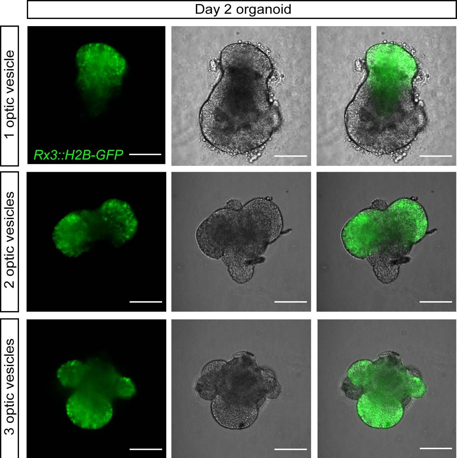 Examples of organoids generated by aggregation of <1000 cells forming one, two, and three optic vesicle-like structures.Fluorescence images, bright-field images, and their overlay of retinal organoids on day 2 generated from the Rx3::H2B-GFP reporter line formed by aggregation of <1000 primary embryonic pluripotent cells stained with anti-GFP antibody. Scale bar: 100 μm. Image collected and cropped by CiteAb from the following open publication (//pubmed.ncbi.nlm.nih.gov/34252023), licensed under a CC-BY license. Not internally tested by R&D Systems.