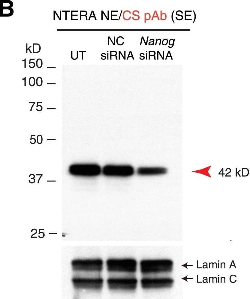 Characterization of Nanog proteins in NTERA-2 cells upon siRNA-mediated knockdown.(A) Nanog siRNA experiments in NTERA-2 cells. NTERA-2 cells were transfected with a pool of Nanog-specific siRNAs for 48 h, harvested, and used to isolate the NE for WB with the Kamiya Ab. The left and right panels represent the short and long exposure (SE and LE, respectively) films (note that the left bottom panel is the shortest exposed film to illustrate the significant knockdown of the 42 kD band). Lamin A/C was the loading control. UT, untransfected; NC siRNA, negative control (siCONTROL non-targeting) siRNAs; Nanog siRNA, SMARTpool siRNA against Nanog. Red, black, and blue arrowheads indicate the major 42 kD, minor 35 kD, and 48 kD protein bands, respectively, that were reduced upon Nanog knockdown. The green arrows refer to additional bands that also showed reduction. (B) The WB was performed with the CS anti-Nanog rabbit pAb. Image collected and cropped by CiteAb from the following open publication (//pubmed.ncbi.nlm.nih.gov/24598770), licensed under a CC-BY license. Not internally tested by R&D Systems.