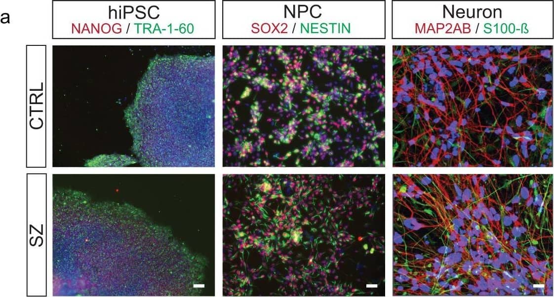 Combinatorial histone hyperacetylation in SZ neurons.a Representative (repeated >3X/group) patient-specific hiPSCs, NPCs, and neurons. Left-hiPSCs express NANOG (green) and TRA-1-60 (red). DAPI (blue). Center-hiPSC neural progenitor cells (NPCs) express NESTIN (green) and SOX2 (red). DAPI (blue). Right-hiPSC neurons express S100 calcium-binding protein B (green) and the dendritic marker MAP2AB (red). DAPI (blue). Scale bar 100 μm. b Heatmap depicting LC-MS/MS data for relative enrichment values of (un)modified and acetylated histones H2AZ.1 and H2AZ.2 in hiPSCs (n = 3/group), NPC (n = 3/group), and 4-week-old neurons from SZ vs. matched controls (n = 4/group). Absolute values (% total peptide) for each peptide are provided. Fold differences between SZ vs. controls are represented (biologically independent replicates/cell-type/condition). Heatmap data represented as means, *p ≤ 0.05, **p ≤ 0.01, ****p ≤ 0.0001 (two-tail Student’s t-tests performed within cell-type, SZ vs. CTRL; adjustments were not made for multiple comparisons). Please see Supplementary Data 1 for LC-MS/MS source data. Increased patterns of H2A.Z acetylation were confirmed via western blotting in c 4-week-old hiPSC neurons [n = 3 (SZ) vs. 4 (CTRL) biologically independent replicates], *p = 0.0538 (two-tail Student’s t-tests), and in d DLPFC from biologically independent postmortem SZ subjects vs. matched controls (n = 9 per group; two-tail Student’s t-tests), *p = 0.0510. Total H2A.Z and GAPDH were used as normalization controls, respectively. A.U. = arbitrary units (normalized to CTRL samples). Data are presented as averages ± SEM. Source data are provided in Source Data files. Image collected and cropped by CiteAb from the following open publication (//pubmed.ncbi.nlm.nih.gov/35459277), licensed under a CC-BY license. Not internally tested by R&D Systems.