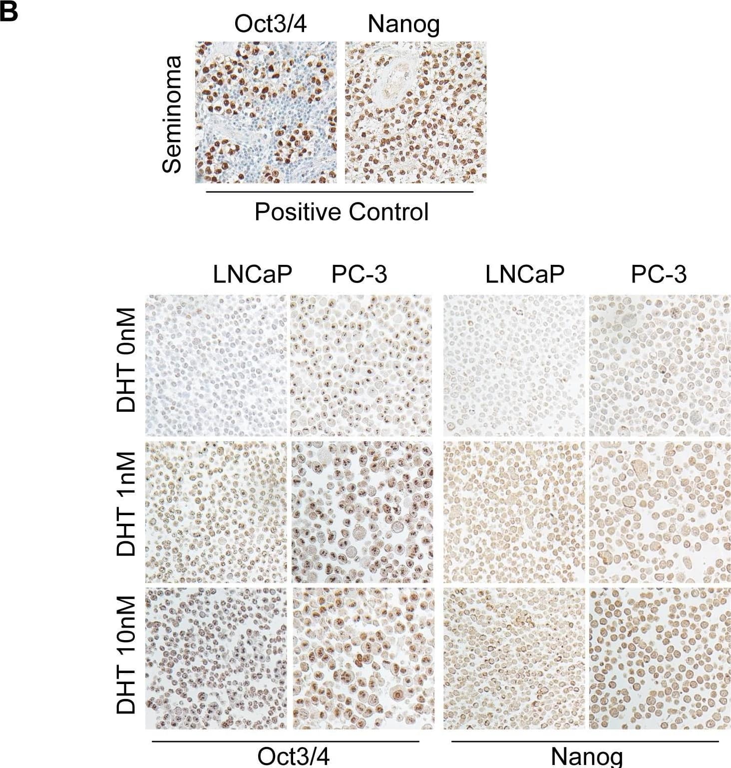 DHT increases Oct3/4 and Nanog expressions in prostate cancer cell lines.(A) The higher expressions of Oct3/4 and Nanog by immunoblotting assay are shown in LNCaP and PC-3 cells treated with 1 nM and 10 nM DHT treatments, respectively, for variable periods of times. (B) The immunocytochemical staining shows higher levels of these two factors in both cell lines treated with different concentrations of DHT. Human seminoma tissue sections were used as positive controls for these two antibodies (bar scale: 50 µm). Image collected and cropped by CiteAb from the following open publication (//pubmed.ncbi.nlm.nih.gov/23936228), licensed under a CC-BY license. Not internally tested by R&D Systems.