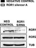 Knockdown of ROR1 in serous ovarian cancer cells decreases migrationA. ROR1 is decreased at the mRNA level following ROR1 siRNA (A) induced knockdown in serous ovarian cancer (OVCAR3) cells. No effect on ROR2 mRNA level. qRT-PCR was performed in triplicate and normalised to three different housekeeping genes (SDHA, HSPCB, RPL13A). Results represent an average of three experiments. Error bars represent the s.d of the mean. **P < 0.01. B. Densitometric analysis of ROR1 and ROR2 protein levels from three separate experiments. Representative immunoblots showing ROR1 knockdown at the protein level in OVCAR3 cells. No effect on ROR2 protein level. Top panel: ROR1, middle panel: ROR2, bottom panel:  alpha -tubulin. C. Cell proliferation does not change following ROR1 knockdown in OVCAR3 cells over a 48–72 hour period. Results represent the average of three independent experiments. Error bars represent the s.d of the mean. D. ROR1 knockdown has no effect on the adhesion of OVCAR3 cells to collagen or fibronectin. Results represent the average of 3 experiments and error bars represent the s.d of the mean. E. Cell migration performed using the wound healing assay decreases following ROR1 knockdown in OVCAR3 cells. Results represent an average of three experiments. Error bars represent the s.d of the mean. *P < 0.05. F. Relative cell migration performed using the transwell migration assay is significantly decreased following ROR1 knockdown in OVCAR3 cells. Results represent an average of three experiments. Error bars represent the s.d of the mean. **P < 0.01. G. Relative cell invasion performed using the matrigel pre coated transwell assay is significantly decreased following ROR1 knockdown in OVCAR3 cells. Results represent the average of three experiments. Error bars represent the s.d of the mean. **P < 0.01. H. Representative picture of OVCAR3 cells invading matrigel over 48 hours. Image collected and cropped by CiteAb from the following publication (//pubmed.ncbi.nlm.nih.gov/26515598), licensed under a CC-BY license. Not internally tested by R&D Systems.