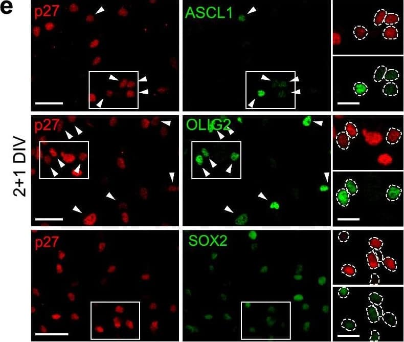 Deregulation of SOX2, ASCL1&OLIG2 TFs in p27KO cultures at the onset of differentiation. e Immunocytochemistry for p27 (red) in combination with ASCL1, OLIG2 or SOX2 (green) in 2 + 1DIV NPCs. Image collected & cropped by CiteAb from the following open publication (//pubmed.ncbi.nlm.nih.gov/36627412), licensed under a CC-BY license. Not internally tested by R&D Systems.