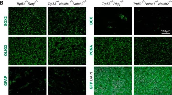 Immunohistochemical analysis of Trp53-/-Notch1-/-Notch2-/- and Trp53-/-Rbpj-/- tumors. (A) A Trp53-/-Notch1-/-Notch2-/- tumor in the SVZ. Streams of tumor cells invading the brain parenchyma are indicated by arrowheads. The GFP expression from the Rosa-CAG::GFP Cre-reporter indicates derivation from Hes5+ cells. (B) Expression of GFP, progenitor (SOX2) and glial markers (OLIG2, GFAP), as well as staining for mitotically active cells (PCNA) and immature neurons (DCX) in Trp53-/-Notch1-/-Notch2-/- and Trp53-/-Rbpj-/- tumors. Image collected and cropped by CiteAb from the following open publication (//pubmed.ncbi.nlm.nih.gov/36358826), licensed under a CC-BY license. Not internally tested by R&D Systems.