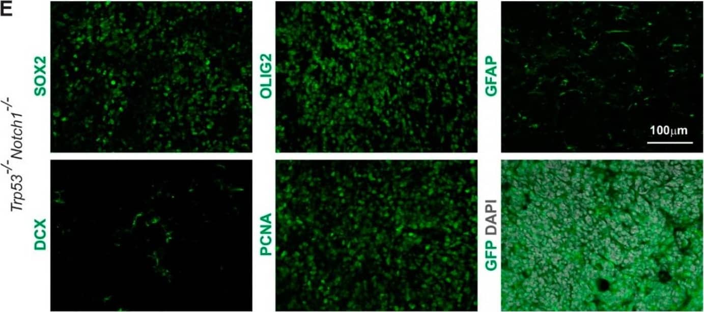 Notch1 and Trp53 deletion in Hes5+ cells leads to formation of forebrain tumors in adult mice. (A) Kaplan–Meier curves showing survival of Hes5::CreERT2 Trp53-/-Notch1-/- and Trp53-/-Notch2-/- mutant mice. (B) A Trp53-/-Notch1-/- tumor in the forebrain. The GFP expression from the Rosa-CAG::GFP Cre-reporter indicates derivation from Hes5+ cells. (C) Percentages of Trp53-/-Notch1-/- and Trp53-/-Notch2-/- mice that developed hyperplasia or tumors in the brain. (D) A Trp53-/-Notch1-/- tumor (dashed line) in the anterior forebrain. In contrast, the forebrain of Trp53-/-Notch2-/- mice appears grossly normal. (E) Expression of GFP, progenitor (SOX2) and glial markers (OLIG2, GFAP), as well as staining for mitotically active cells (PCNA) and immature neurons (DCX) in Trp53-/-Notch1-/- tumors. Image collected and cropped by CiteAb from the following open publication (//pubmed.ncbi.nlm.nih.gov/36358826), licensed under a CC-BY license. Not internally tested by R&D Systems.