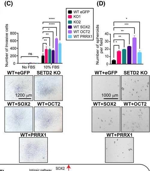 SOX2, OCT2, and PRRX1 are downstream effectors of the SETD2‐regulated EMT program. (A) Expression of SOX2, OCT2, and PRRX1 in TGF‐ beta ‐treated WT (72 h), SETD2 KO, and SETD2 rescue tested by RT‐qPCR (run in triplicate). (B) Migration capacity by wound healing assay, (C) invasiveness by transwell assay, and (D) stemness by 3D spheroid formation assay in RPTEC WT GFP (control vector), SETD2 KO1 and KO2, and SOX2/OCT2/PRRX1‐transduced WT RPTEC lines. Images are taken at 4× magnification, scale bar: 1000 μm for (B) and (D) and at 2.5× magnification, scale bar: 1200 μm for (C). Data are represented as mean ± SEM for triplicate reactions for B–D. P‐value is calculated by one‐way ANOVA in (A), (B), and (D). Two‐way ANOVA is used for statistical test for (C). ****P < 0.0001; ***P < 0.001; **P < 0.01; *P < 0.05; ns, P ≥ 0.05. (E) Model of the SETD2 loss‐driven EMT program through cell intrinsic (transcriptional) and cell extrinsic (paracrine) mechanisms. Image collected and cropped by CiteAb from the following open publication (//pubmed.ncbi.nlm.nih.gov/37418588), licensed under a CC-BY license. Not internally tested by R&D Systems.