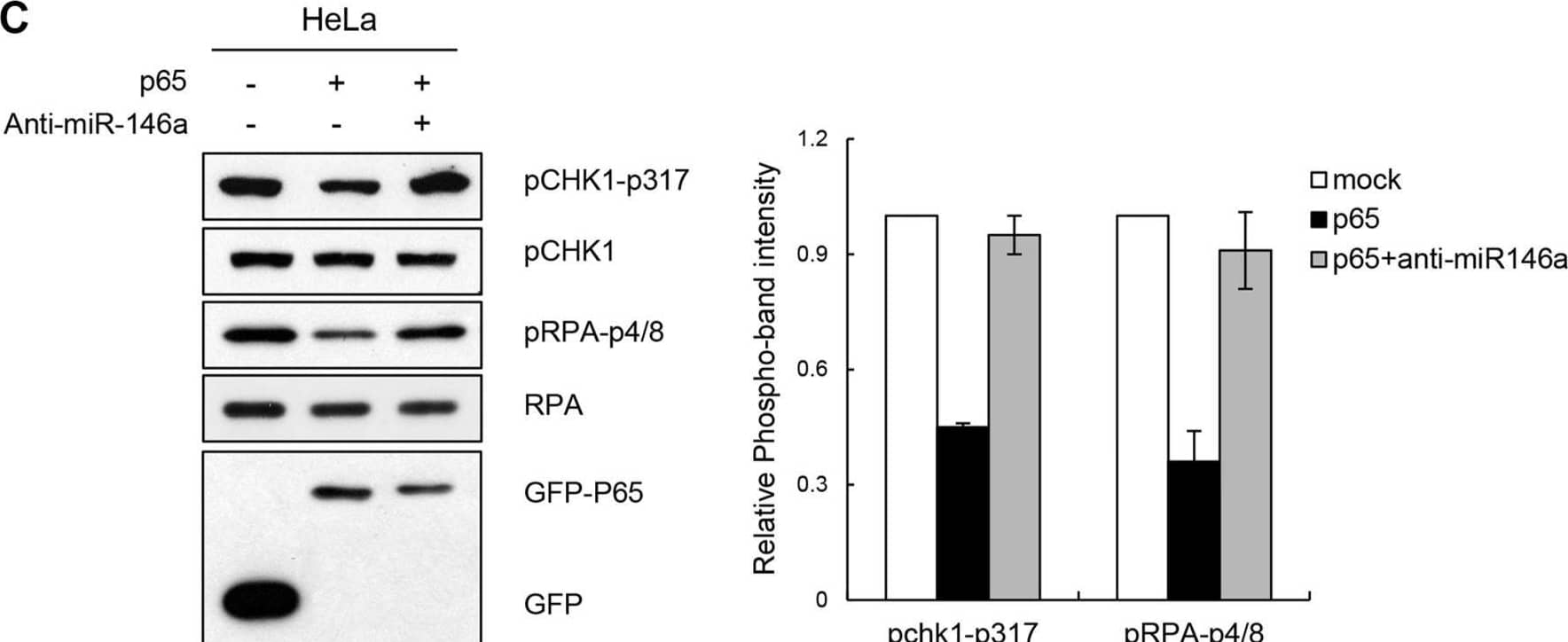 NF-kappa B reiterating miR146a function in the FA pathway and replication fork restart(A) Two days after transfection of cells with p65 cDNA and anti-miR146a in combination as indicated, cells were treated with 5 mM HU for 5 h. The levels of FANCM and p63 proteins, and FANCD2 ubiquitination were measured by western blotting. (B) After undergoing the same treatment as (A) HeLa cells were analyzed for FANCD2 foci formation. Results are shown as the mean ± SD (n = 3); **P < 0.01. (C) Under the same conditions described in (A) cell lysates were analyzed by western blotting with antibodies against pCHK1-S317, CHK1, pRPA-S4/8, RPA, and GFP. Right, quantitation of pCHK1-S317 and pRPA-S4/8 expression. Results are shown as the mean ± SD (n = 3). (D) GES-1 cells transfected with p65 construct were applied to DNA fiber analysis. Resulting images of DNA fibers of p65-overexpressing cells compared with control cells (top). CldU tract length distribution was determined (bottom). (E) HeLa or GES-1 cells with the same treatment as A were subjected to  gamma -H2AX detection. Results are shown as the mean ± SD (n = 3); **P < 0.01. (F) HeLa and GES-1 cells were transfected with p65 construct and Anti-miR146a in combinations as indicated and were treated with different doses of HU for 5 hr. Cell survival thereafter was measured using clonogenic survival assay. Results are shown as the mean ± SD (n = 3); **P < 0.01. Image collected and cropped by CiteAb from the following open publication (//pubmed.ncbi.nlm.nih.gov/27351285), licensed under a CC-BY license. Not internally tested by R&D Systems.