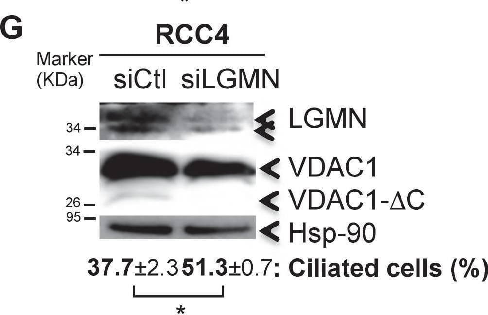 Western Blot Legumain/Asparaginyl Endopeptidase Antibody [Unconjugated]