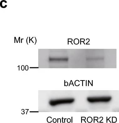 Western Blot ROR2 Antibody [Unconjugated]