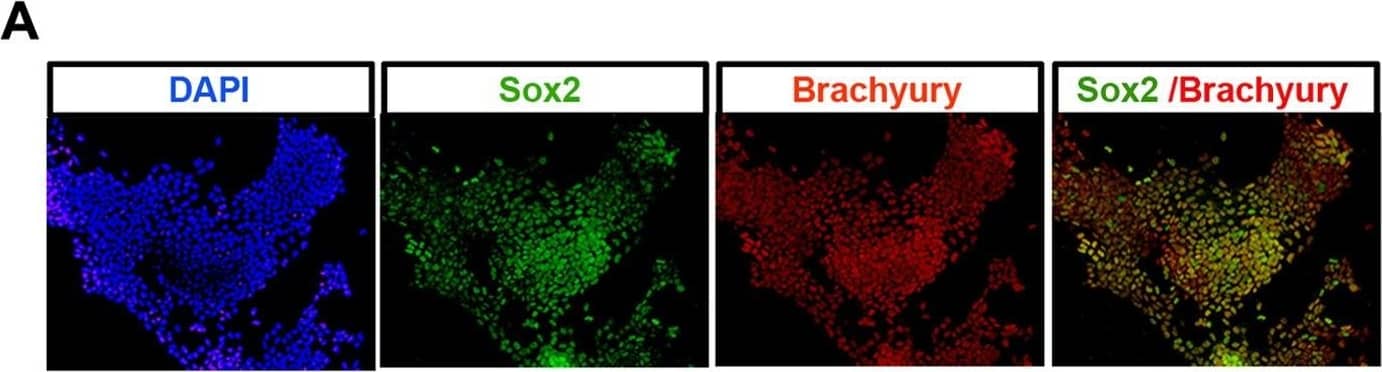 Generation of NMPs from EpiSCs.(A) Brachyury/Sox2 immunocytochemistry in EpiSC cultures treated with FGF/CHIR for 72 h. (B) qPCR analysis for indicated markers in mouse EpiSCs treated with FGF/CHIR. Error bars = s.d. (n = 3). n/d, not determined. Results are represented as log10 ratio of expression versus untreated EpiSCs. The data used to generate the plot can be found in Data S4. (C) Combined fluorescence/brightfield microscopy showing donor cell incorporation of grafted GFP+ EpiSC differentiated for 48 h in FGF/CHIR after 48 h embryo culture. (D) Table summarizing the incorporation of grafted GFP+ EpiSC differentiated for 24 h or 48 h in Fgf/Wnt within host embryos. NT, neural tube; Som, somite; PSM, presomitic mesoderm; n/a, not applicable. (E) Representative examples of donor cell incorporation (green, GFP) and differentiation (red, immunofluorescence for indicated markers). Cell nuclei were stained with DAPI (blue). White boxes indicate the position of magnified images of GFP+ cells. Image collected and cropped by CiteAb from the following open publication (//pubmed.ncbi.nlm.nih.gov/25157815), licensed under a CC-BY license. Not internally tested by R&D Systems.