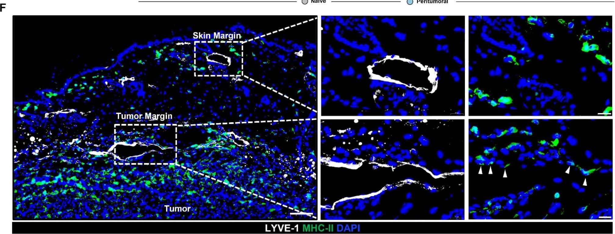 Peritumoral LECs upregulate MHC-II, PD-L1, and various co-inhibitory molecules compared to naïve dermal LECs. (A) Schematic of experimental design analyzing naïve dermal LECs in the ear and peritumoral LECs of the same mice. (B) Quantification of MHC-II and PD-L1 positivity in naïve and peritumoral LECs (CD45- podoplanin+ CD31+) at day 7, 14, and 21 post B16F10 tumor inoculation in WT (C57/BL6) mice. (C) Quantification of MHC-II and PD-L1 positivity in naïve and peritumoral LECs at day 14 post E0771 tumor inoculation in WT mice. (D) Quantification of MHC-II and PD-L1 positivity in naïve and peritumoral LECs in MMTV-PyMT mice with spontaneous mammary tumors. (E) Quantification of PD-L2, HVEM, and CD48 positivity in naïve and peritumoral LECs at day 21 post B16F10 tumor inoculation in WT mice. (F) Representative immunofluorescence image stained for LYVE-1 (white) and MHC-II (green) in peritumoral and skin margin lymphatics in WT mice at day 14 post B16F10 inoculation. DAPI nuclear staining in blue. Scale bars, 100 μm (left), 20μm (top right and bottom right). Statistical significance assessed using paired student’s t test on data from at least 3 biological replicates; error represented as SD. *, p < 0.05; **, p < 0.01; ***, p < 0.001. Image collected and cropped by CiteAb from the following open publication (//pubmed.ncbi.nlm.nih.gov/36362253), licensed under a CC-BY license. Not internally tested by R&D Systems.