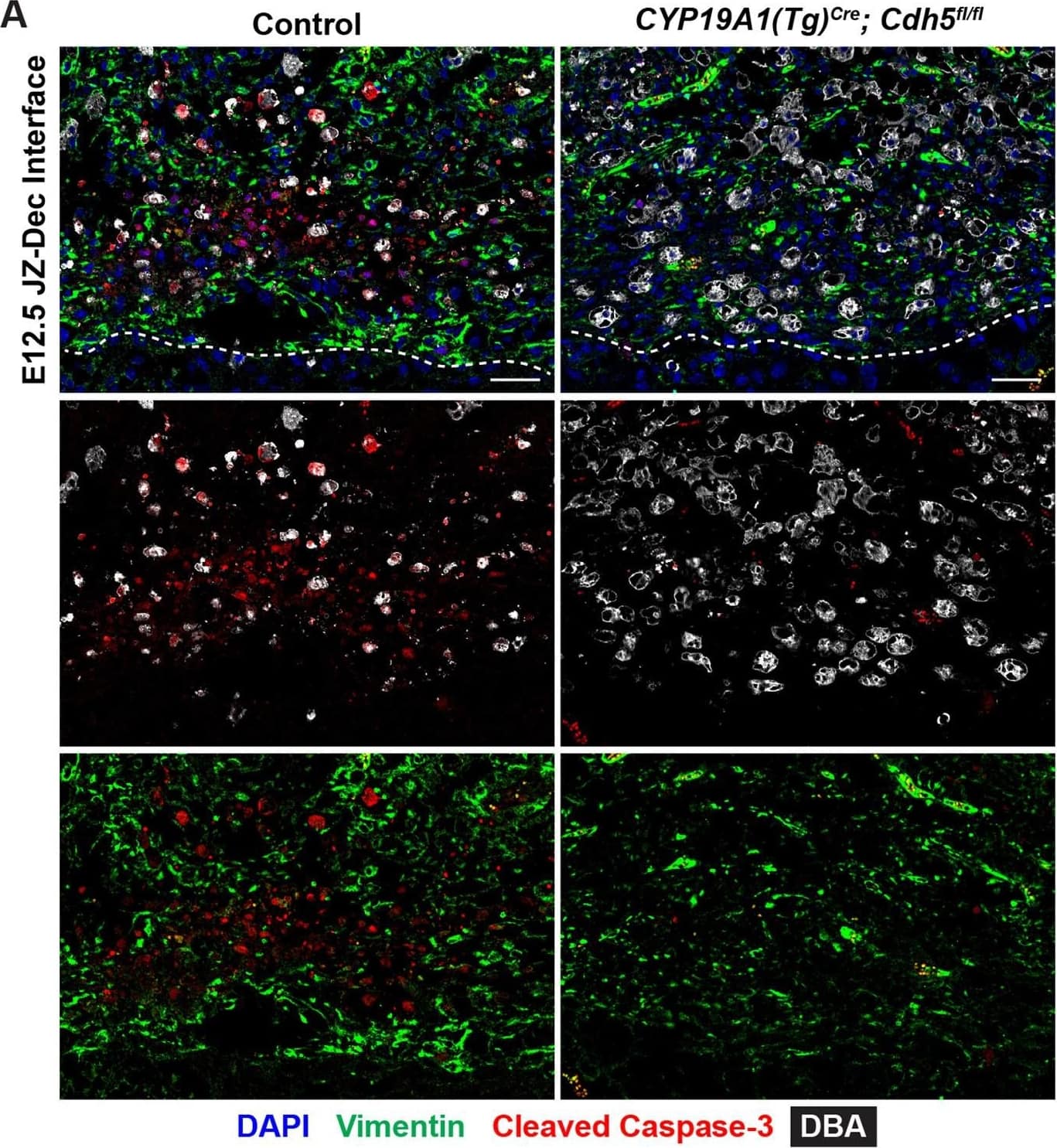 Persistent uterine natural killer (uNK) cells at the junctional zone-decidual interface of Cdh5 knockout placentas.(A) Immunofluorescence staining for DBA (a lectin that specifically binds uterine natural killer (uNK) cells, gray), vimentin (green), and cleaved caspase-3 (red).Dotted line demarcates the border of the junctional zone and decidua. Scale bars = 50 μm. (B, C) Quantification of DBA+ cell density and cleaved caspase-3+ cell density in the decidua. (D) Gene ontology (GO) analysis of upregulated biological process terms related to NK cells. Statistical analysis was performed using two-tailed, unpaired Welch’s t-test. Data are shown as means ± SD.Figure 4—figure supplement 2—source data 1.Excel file containing quantification for uterine natural killer cell density and apoptotic cell density in Figure 4—figure supplement 2.Excel file containing quantification for uterine natural killer cell density and apoptotic cell density in Figure 4—figure supplement 2. Image collected and cropped by CiteAb from the following open publication (//pubmed.ncbi.nlm.nih.gov/35486098), licensed under a CC-BY license. Not internally tested by R&D Systems.