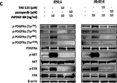 Inhibitory activities of TAS-115 and pazopanib on c-MET, PDGFR alpha  and their downstream effectors in vitro. a Yamato-SS cells (c-MET-dependent SS cells) were treated with 0.1 μM TAS-115 or pazopanib or control (0.1% DMSO) for 3 h. b Yamato-SS cells were treated with 0.001–20 μM of pazopanib or control (0.1% DMSO) for 3 h. c SYO-1 and HS-SY-II (PDGFR alpha -dependent) SS cells were treated with 10-μM TAS-115 or pazopanib or control (0.1% DMSO) for 3 h, followed by an additional treatment with rhPDGF-BB at a concentration of 10 ng/ml for the last 15 min Image collected and cropped by CiteAb from the following open publication (//pubmed.ncbi.nlm.nih.gov/28511645), licensed under a CC-BY license. Not internally tested by R&D Systems.