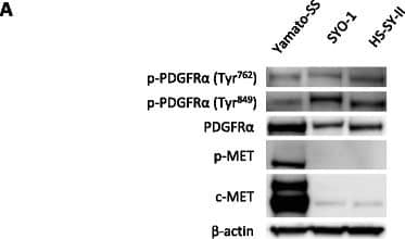 c-MET and PDGFR alpha  signals are crucial for the proliferation of SS cells. a Phosphorylation status of RTKs in 3 SS cell lines. b Yamato-SS (3 × 103), SYO-1 (5 × 103) and HS-SY-II (1 × 104) cells were transfected with siRNAs against c-MET. Transfected cells were cultured for 96 h and relative cell proliferation rates were measured using a WST-1 assay. Bars represent the SD. * p < 0.05. c Growth of Yamato-SS (3 × 103), SYO-1 (5 × 103) and HS-SY-II (1 × 104) cells transfected with siRNAs against PDGFR alpha . Relative cell proliferation rates were determined using a WST-1 assay after 96 h. Bars represent the SD. * p < 0.05 Image collected and cropped by CiteAb from the following open publication (//pubmed.ncbi.nlm.nih.gov/28511645), licensed under a CC-BY license. Not internally tested by R&D Systems.