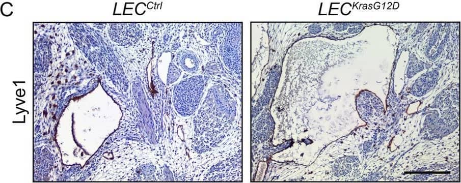 LECKrasG12D embryos have enlarged jugular lymph sacs & malformed lymphovenous valves. (A). Schematics of the Lyve1-Cre & KrasLSL-G12D alleles. (B). Representative images of E14.5 LECCtrl & LECKrasG12D embryos. The LECKrasG12D embryo has edema. (C). Transverse sections of E14.5 embryos stained with an anti-Lyve1 antibody (brown) & hematoxylin (purple). (D). Jugular lymph sac area was significantly greater in LECKrasG12D embryos (273391 ± 47694; n = 6 mice) than LECCtrl embryos (76949 ± 17566; n = 5 mice). (E). Coronal sections of E14.5 embryos stained with hematoxylin & eosin (H&E). The arrow points to a lymphovenous valve in a LECCtrl embryo. The arrow points to a cluster of cells in the lymphovenous valve region in a LECKrasG12D embryo. Six LECCtrl & five LECKrasG12D embryos were analyzed. (F). Coronal sections of E14.5 embryos stained with DAPI (blue) & antibodies against Lyve1 (yellow) & endomucin (red). The arrow points to a lymphovenous valve in a LECCtrl embryo. The arrow points to a cluster of Lyve1-positive cells in the lymphovenous valve region in a LECKrasG12D embryo. Five LECCtrl & three LECKrasG12D embryos were analyzed. (G). Immunostaining revealed that cell clusters in the jugular lymph sacs of LECKrasG12D embryos contained Prox1 & Lyve-1 double-positive LECs. Six LECKrasG12D embryos were analyzed. (H). Higher magnification image of cluster in panel (G). (I,J). Clusters also contained F4/80-positive cells (I) & CD45-positive cells (J). (K). Immunostaining revealed that clusters in LECKrasG12D embryos contained Runx1-positive cells. (L–O). Higher magnification images of the separate channels in panel (K). Data are presented as mean ± SEM. **p < 0.01; unpaired Student’s t-tests. Scale bar in panel C = 200 µm. Scale bars in panels E, G, I, J, & K = 100 µm. Image collected & cropped by CiteAb from the following open publication (//pubmed.ncbi.nlm.nih.gov/37842094), licensed under a CC-BY license. Not internally tested by R&D Systems.