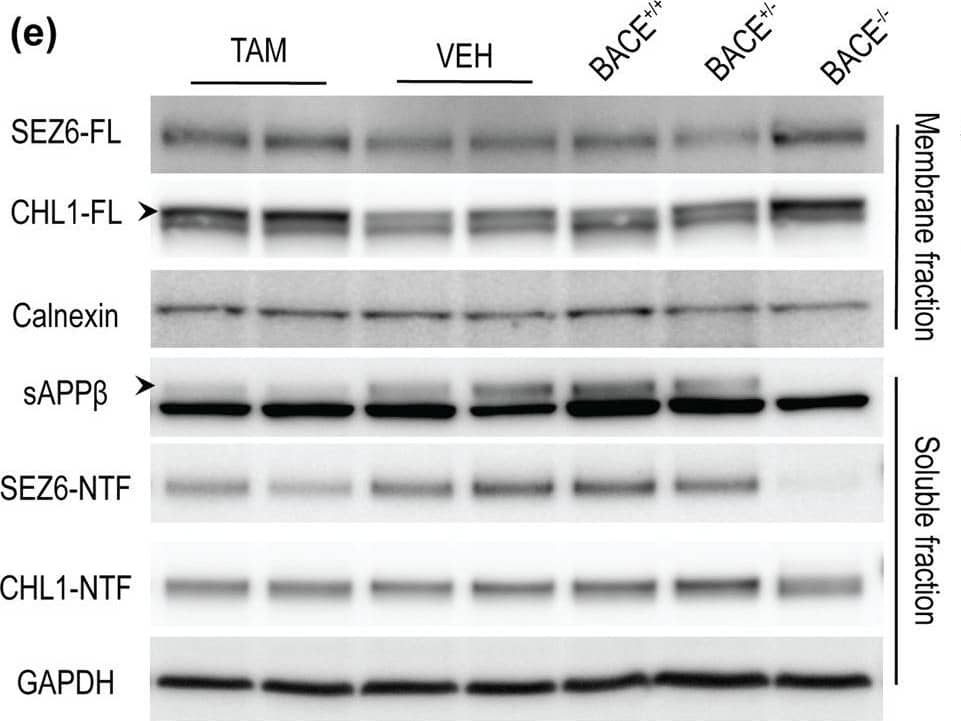 Western Blot CHL-1/L1CAM-2 Antibody [Unconjugated]