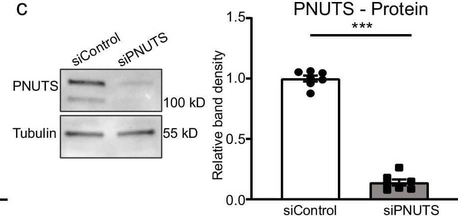 PNUTS is an aging-regulated protein and regulates senescence in endothelial cells. A HUVECs were cultured for 3 or 17 passages (P) and PNUTS expression was measured by qRT-PCR (n = 4). b Aortic intima was isolated from young (8–12 weeks old) and aged (18–20 months old) mice and immediately lysed for RNA isolation. Intima RNA was sequenced. c–f HUVECs were transfected with siRNAs targeting PNUTS or a control sequence. c PNUTS protein levels were determined by WB at 48 h after transfection, relative to alpha-tubulin. Densitometric quantification is depicted on the right (n = 7). d Changes in p21 expression were assessed by qRT-PCR. Expression values are relative to siControl-treated HUVECs and normalized to RPSA mRNA (n = 6). e The percentage of senescent HUVECs was analyzed by staining for senescence-associated  beta -Galactosidase (SA-( beta -Gal) 72 h after transfection. Images were taken (4 fields per sample) and the percentage of senescent cells (blue) over the total number of cells in each field was calculated in n = 3 independent experiments, 2–3 biological replicates per group and experiment). f Cell proliferation was assayed by testing the incorporation of EdU after transfection (n = 4). *p < 0.05, **p < 0.01, ***p < 0.001. Error bars depict the standard error of the mean (SEM). Image collected and cropped by CiteAb from the following open publication (//pubmed.ncbi.nlm.nih.gov/38714838), licensed under a CC-BY license. Not internally tested by R&D Systems.