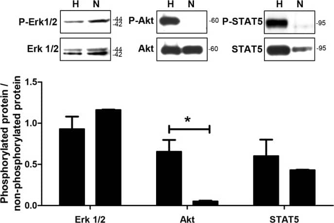 Effects of hypoxia generated by using the insert-based enzymatic system on the phosphorylation of cell signalling molecules. Several molecules associated with cellular signalling and survival events are differentially phosphorylated between the hypoxia (H) and normoxia (N) groups at 2 hours after the hypoxic insult. One representative western blotting experiment is shown above the columns. Bars denote mean ± s.e.m. of three experiments; *P<0.05. Image collected and cropped by CiteAb from the following publication (//journals.biologists.com/dmm/article/doi/10.1242/dmm.013078/258749/An-insert-based-enzymatic-cell-culture-system-to), licensed under a CC-BY license. Not internally tested by R&D Systems.