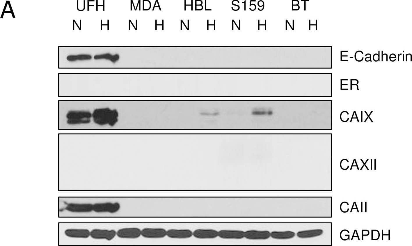 Differential expression of CAs in TNBC and luminal breast cancer cells. Cell were grown to 70% confluence and then exposed to normoxic (N) or 1% oxygen (H), hypoxic conditions. After 16 h, cells were washed with PBS and extracted in RIPA buffer containing protease inhibitors. Equal protein was loaded onto SDS PAGE gels, and then transferred to nitrocellulose for western blot analysis. Panel A. CA expression in TNBC cells: UFH = UFH-001, MDA = MDA-MB-231-LM2, HBL = HBL-100, S159 = Sum 159, BT = BT-549 cells. Panel B. CA expression in luminal breast cancer cells: T47D, MCF7 = MCF-7, SKBR = SKBR-3, S52 = SUM-52 cells. Image collected and cropped by CiteAb from the following open publication (//pubmed.ncbi.nlm.nih.gov/29965974), licensed under a CC-BY license. Not internally tested by R&D Systems.
