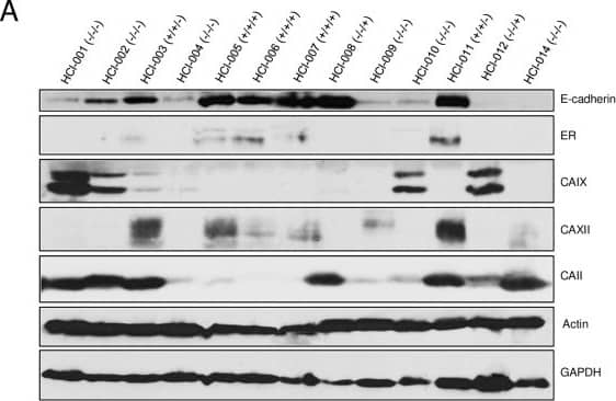 Western Blot Carbonic Anhydrase XII/CA12 Antibody [Unconjugated]