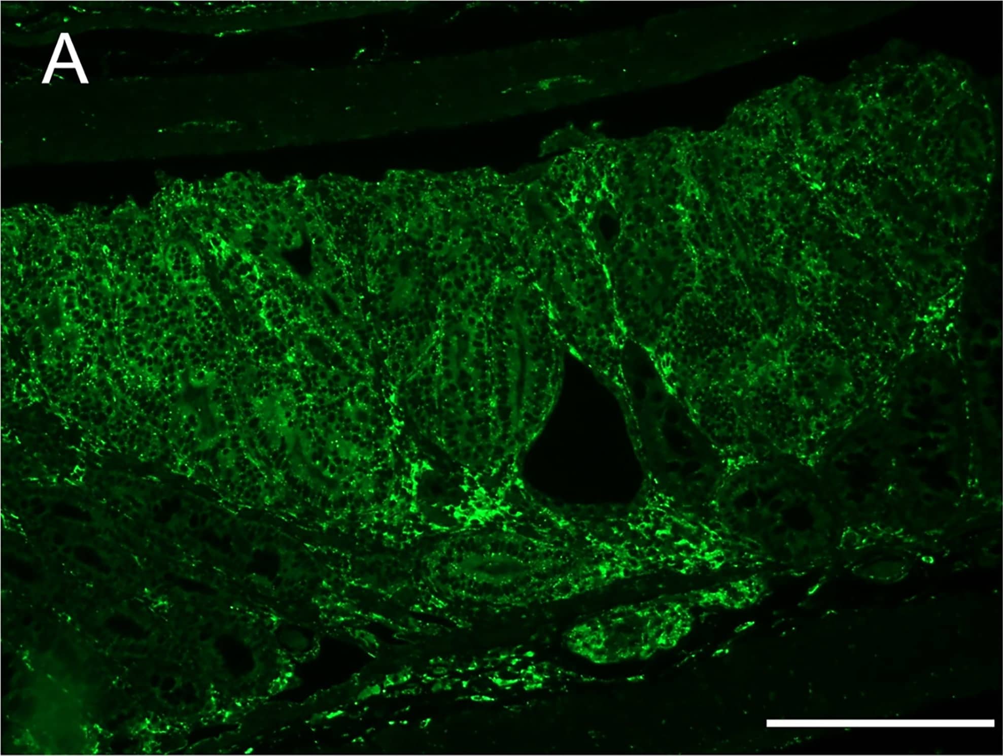 Representative sections showing overall higher expression of legumain (diffuse yellowish fluorescence staining) in the untreated (A) versus the Andosan™-treated (B) intestine.Notably, legumain expression was higher in tumor tissue seen in untreated animals. Scale bars represent 200 μm. Image collected and cropped by CiteAb from the following publication (//pubmed.ncbi.nlm.nih.gov/28002446), licensed under a CC-BY license. Not internally tested by R&D Systems.