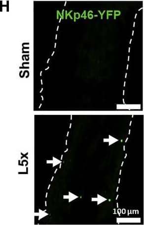 Peripheral Nerve Injury Regulates Raet1 Expression and Injured Sensory Neurons Show Increased Neurite Fragmentation by Stimulated NK Cells. (H) Sciatic nerve tissue sections from adult male NKp46-YFP mice 7 days after L5 spinal nerve transection injury immunolabeled with anti-GFP (NKp46, green). Arrows indicate NK cells in sciatic nerve. Image collected and cropped by CiteAb from the following publication (//linkinghub.elsevier.com/retrieve/pii/S0092867418316362), licensed under a CC-BY license. Not internally tested by R&D Systems.